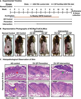 Protective effects of dietary grape against atopic dermatitis-like skin lesions in NC/NgaTndCrlj mice